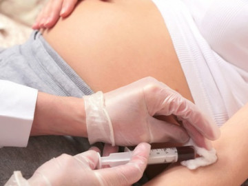 Các xét nghiệm sàng lọc trước sinh Hội chứng Down