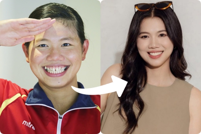 Kình ngư Ánh Viên thăng hạng nhan sắc nhờ niềng răng, dán sứ.