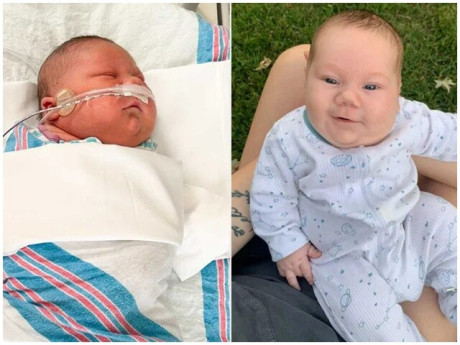 Bà bầu - Một năm sau ngày mất con, người mẹ đón “em bé cầu vồng” nặng gần 6kg khiến cả bệnh viện kinh ngạc