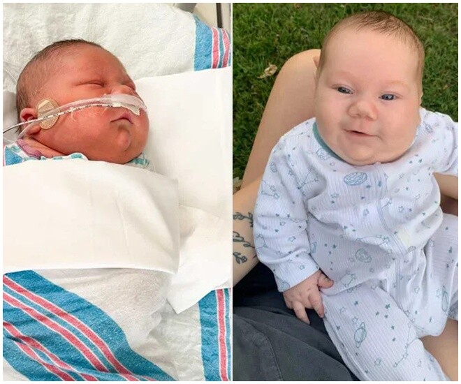 Em bé có kích thước quá lớn khiến người mẹ không thể sinh thường.