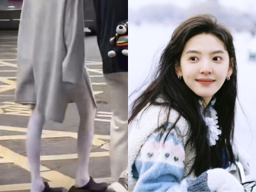 Nữ diễn viên là "người tình trong mộng" của showbiz: Nhan sắc hút 70 triệu lượt xem, nay chân "teo tóp" nhìn mà sợ