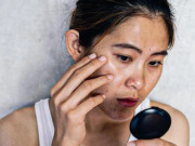 Sức khỏe - 4 bộ phận trên cơ thể bỗng đen lại, có thể đây là tín hiệu “cầu cứu”, đừng chớ chủ quan