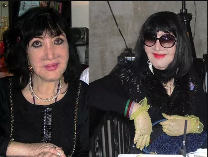 Nhan sắc bị biến dạng của đại mỹ nhân một thời khiến bao người tiếc nuối.