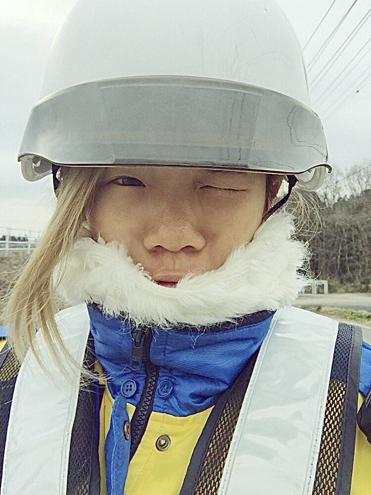 Cô gái amp;#34;vịt hóa thiên ngaamp;#34; sau khi chi 4 tỷ cho hơn 20 cuộc phẫu thuật, nhan sắc trước và sau thẩm mỹ khó tin nổi - 2