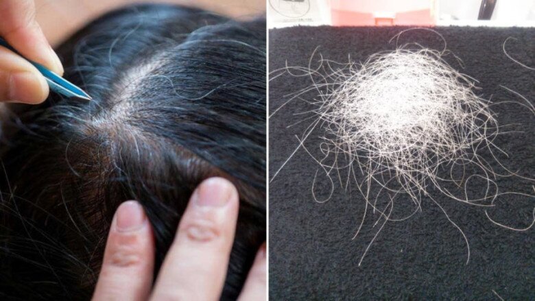 Thỉnh thoảng nhổ tóc bạc có thể không sao nhưng nếu làm thường xuyên có thể gây tổn thương nang tóc.