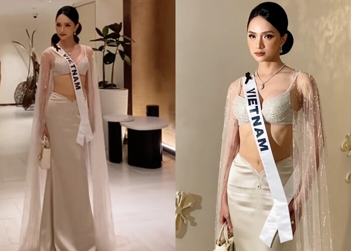 Chi tiết viên kim cương nằm ở ngay vị trí sẹo phía dưới được khen ngợi tinh tế.