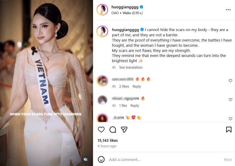 Đăng tải trên trang cá nhân, Hương Giang viết lời chia sẻ bằng tiếng Anh được dịch ra là: Tôi không thể giấu những vết sẹo trên cơ thể mình - chúng là một phần của tôi, và chúng không phải là rào cản. Nó là bằng chứng cho tất cả những gì tôi đã vượt qua, những trận chiền mà tôi đã chiến đấu, và là người phụ nữ mà tôi đã trưởng thành. Vết sẹo của tôi không phải là khuyết điểm, đó là sức mạnh của tôi. Nó nhắc nhở tôi rằng ngay cả những vết thương sâu nhất cũng có thể biến thành ánh sáng rực rỡ nhất