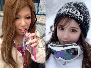 Cô gái vịt hóa thiên nga sau khi chi 4 tỷ cho hơn 20 cuộc phẫu thuật, nhan sắc trước và sau thẩm mỹ khó tin nổi