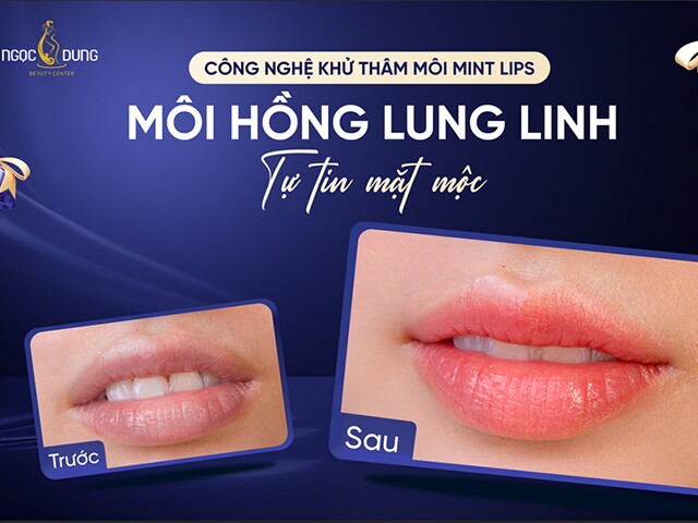 Khử thâm môi Mint Lips có thật sự làm sáng môi chỉ sau 1 buổi không?