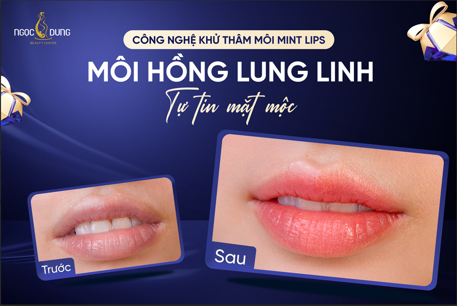 Khử thâm môi Mint Lips có thật sự làm sáng môi chỉ sau 1 buổi không? - 1