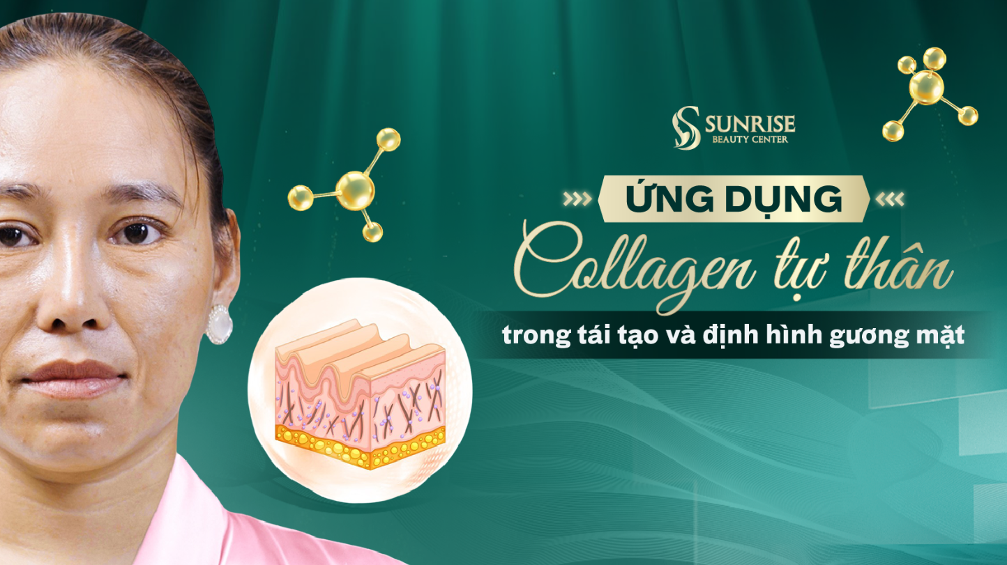Trẻ hóa chuẩn y khoa - Định nghĩa lại vẻ đẹp cùng Bác sĩ Huệ Nguyễn tại Sunrise Beauty - 2