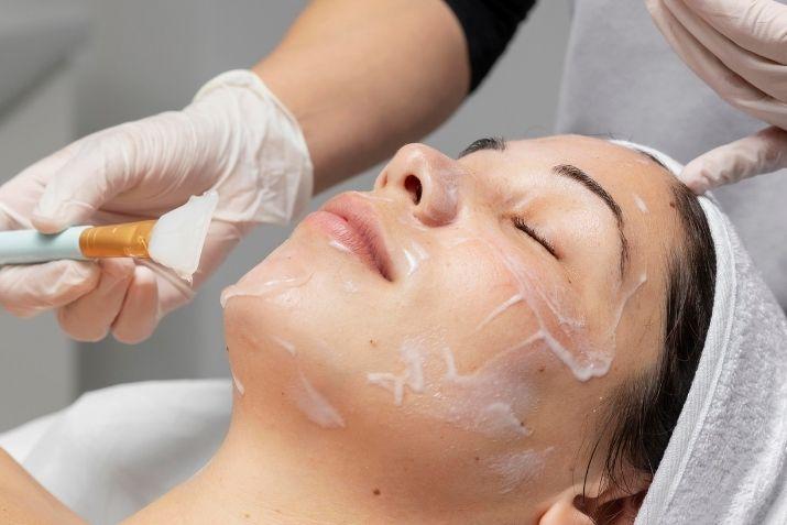 Peel da giúp cải thiện thâm sạm và vấn đề về mụn hiệu quả