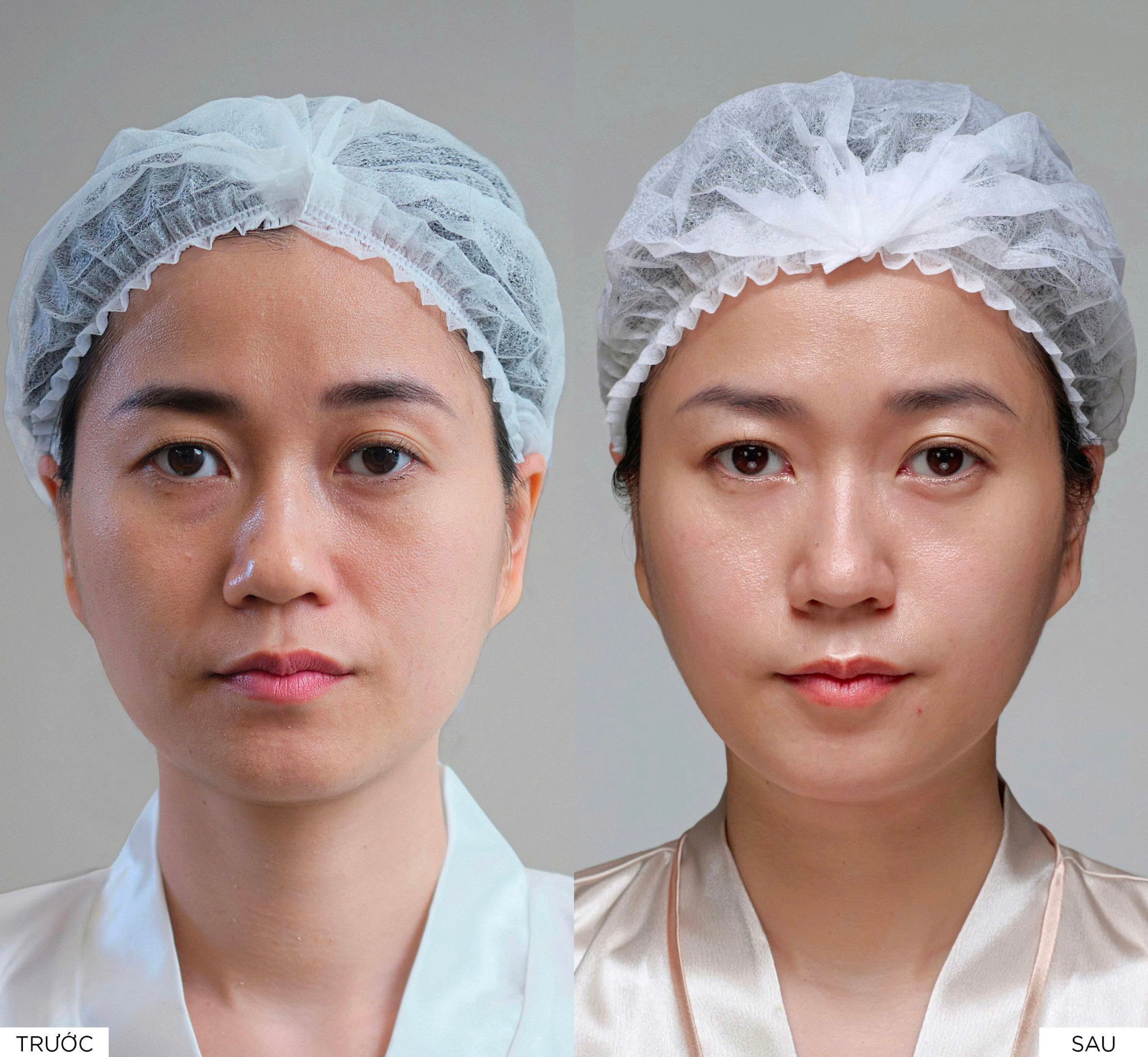 Hiệu quả vượt trội sau 1 phác đồ điều trị