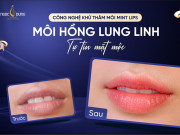Khử thâm môi Mint Lips có thật sự làm sáng môi chỉ sau 1 buổi không?