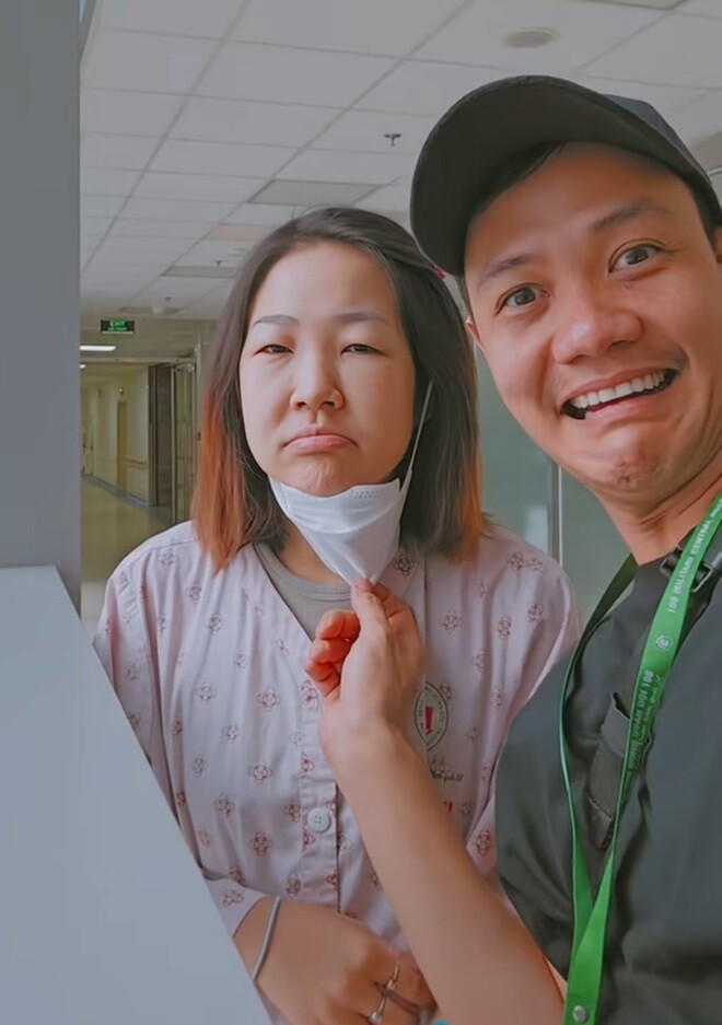 Gương mặt Hoàng Yến phù nề, sưng húp trong quá trình trị bệnh.