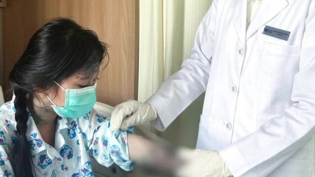 Mẹ tự mua thuốc trị nấm cho con, bé gái 6 tuổi bùng phát vảy nến toàn thân phải cấp cứu khẩn