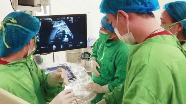 Nỗ lực phút cuối cứu thai nhi 25 tuần tuổi tràn dịch màng phổi tiến triển nhanh