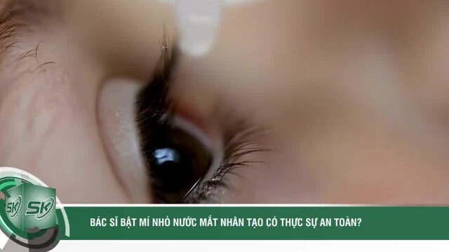 Bác sĩ bật mí nhỏ nước mắt nhân tạo có thực sự an toàn?