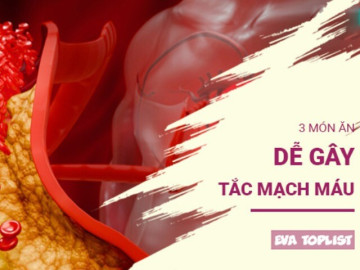 3 món ăn sát thủ thầm lặng đang âm thầm tắc nghẽn mạch máu của bạn
