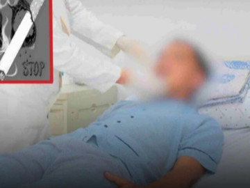 Hút thuốc lá gần 3 thập kỷ, người đàn ông sốc khi phát hiện mắc bệnh cực nguy hiểm