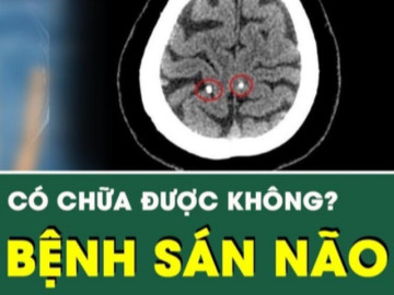 [LIVE] Bệnh sán não có chữa được không?