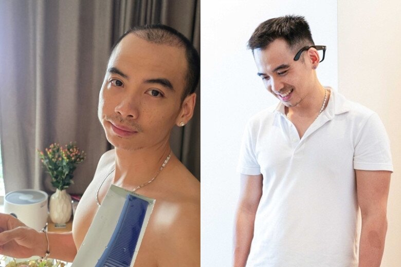 Nam nhiếp ảnh gia được khen ngày càng điển trai hơn với mái tóc dày.