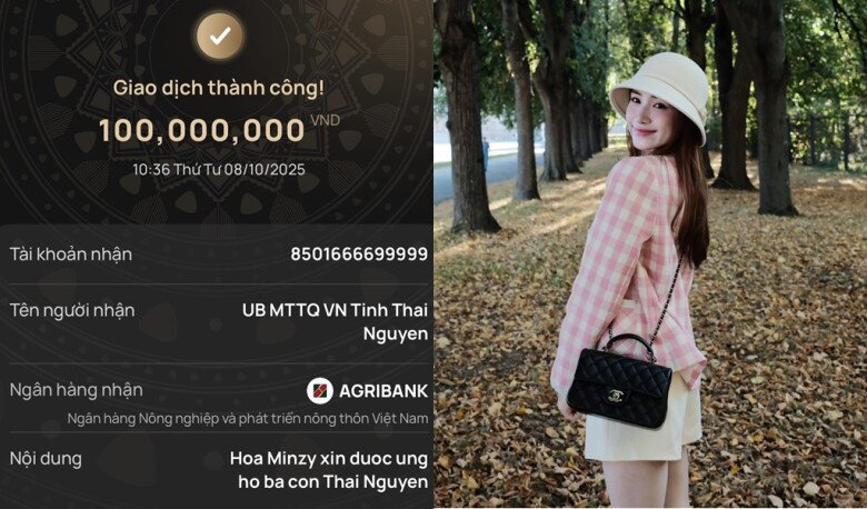 Sao Việt 24h: Lệ Quyên amp;#34;gây sốtamp;#34; vì hành động ngọt ngào khi tình trẻ Lâm Bảo Châu bị thương, được ví như amp;#34;hậu phương vững chắcamp;#34; - 5