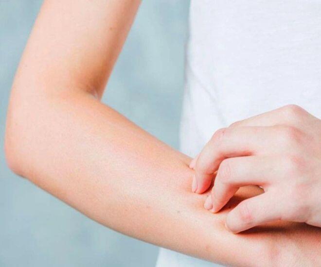 Ngứa da có thể xuất phát từ nhiều nguyên nhân, bạn cần quan sát các biểu hiện để kịp thời điều trị (Ảnh minh hoạ)