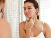 Sức khỏe - 14 dấu hiệu cảnh báo cơ thể đang thiếu hụt dinh dưỡng, nhiều người thường bỏ qua, dễ rước bệnh nặng