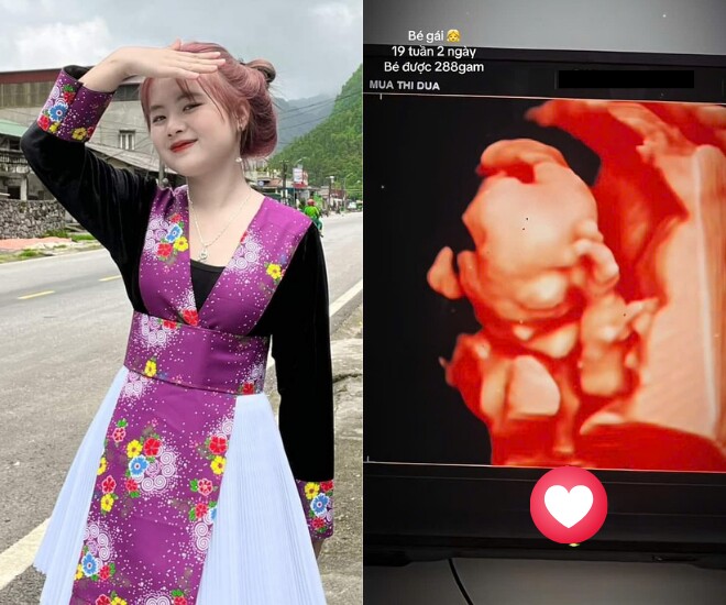 Bé Phúng Phính - Mua Thị Dua khoe ảnh siêu âm con gái đầu lòng.