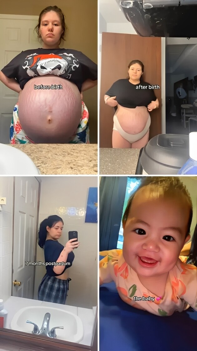 11. Mỗi vết rạn da như kể một câu chuyện đặc biệt, từ những đêm thức trắng, mất ngủ vì bụng căng tức, đến ngắm nhìn thật lâu sự thay đổi của cơ thể trước gương.