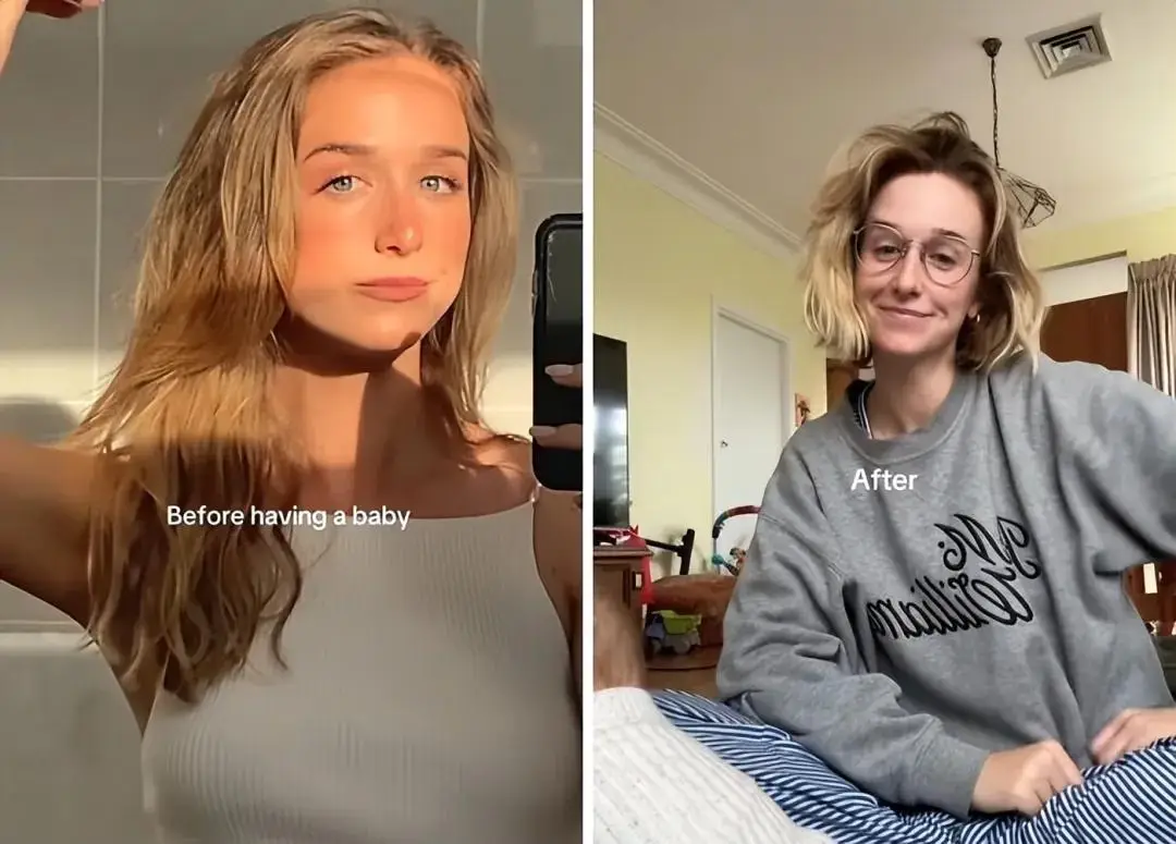 18. Giấc ngủ chỉ còn là ký ức: Sau sinh, cô như một phiên bản “hết pin”, nhưng nụ cười vẫn luôn ở đó.