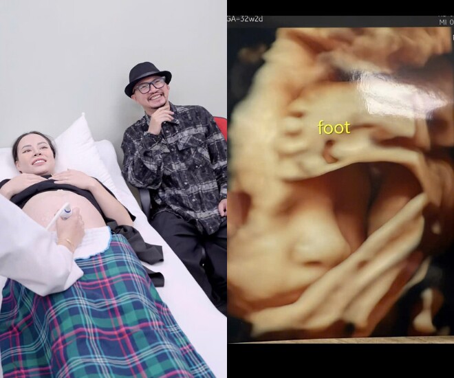 Anh tài Hà Lê đưa vợ đi khám thai, tranh thủ gặp gỡ nhóc tỳ.