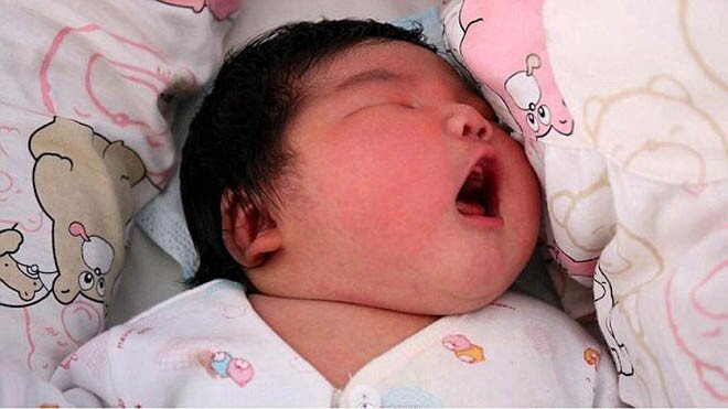 Bà bầu ăn theo thực đơn hằng ngày của mẹ chồng, đứa trẻ sinh ra có ngoại hình khiến cả ê-kíp y tế sửng sốt - 3