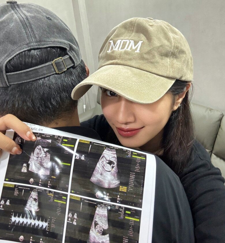 Cả hai đội mũ đôi, bà bầu 9X xinh đẹp rạng rỡ.