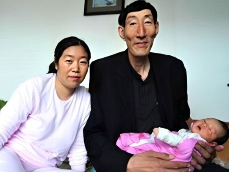 Người đàn ông khổng lồ bất chấp cảnh báo của bác sĩ để sinh con, tình trạng đứa trẻ năm 18 tuổi gây choáng