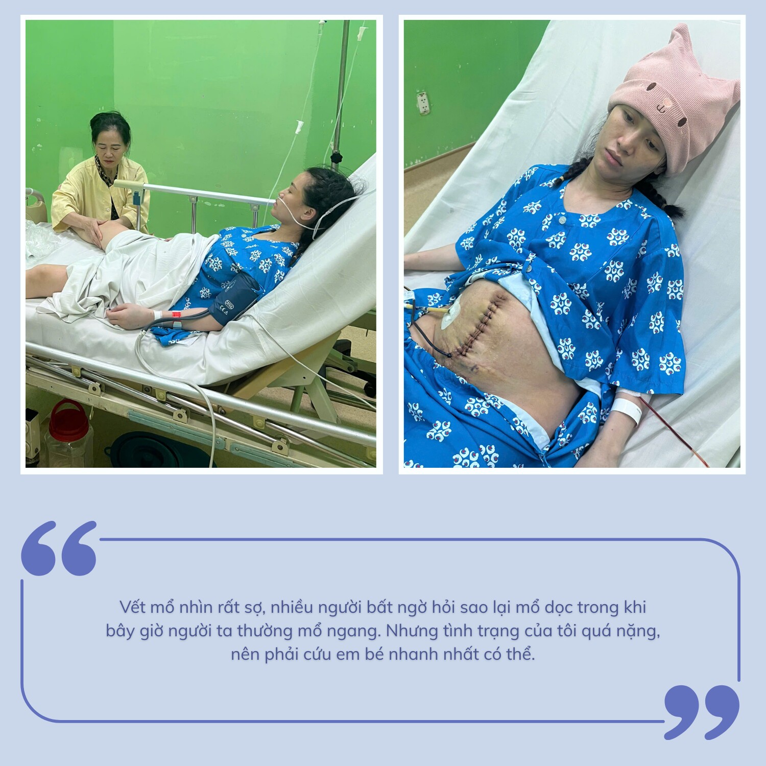 Xem clip: Chị Ngọc cởi mở chia sẻ cận vết mổ sau ca sinh khó, khiến nhiều người xót xa.