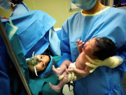 Bà bầu - Bác sĩ đang khâu vết mổ đẻ, sản phụ 36 tuổi bất ngờ hét lên 1 câu giúp cô giữ được mạng sống