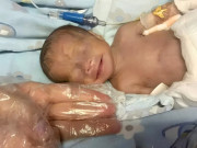 Mẹ lập kỷ lục sinh non đứa bé chỉ bằng 1 quả táo, tình trạng hiện tại sau 128 ngày gây xúc động