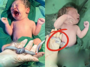 Bà bầu - Em bé chào đời bên vật thể lạ khiến cả ê-kíp đứng tim, hành động tuyệt vời của mẹ khi mang bầu đã cứu lấy con