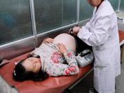 Bà bầu - Nhập viện vì khó tiêu, bà bầu khiến bác sĩ tá hoả khi phát hiện vật thể lạ dài 18cm trong khoang bụng 