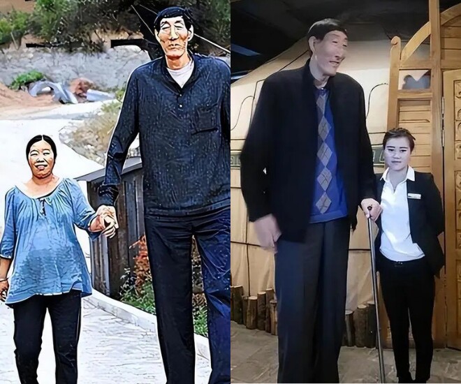 Chiều cao 2,36m của ông Bào Hỷ Thuận mang đến nhiều bất tiện và bị người đời dè bỉu.