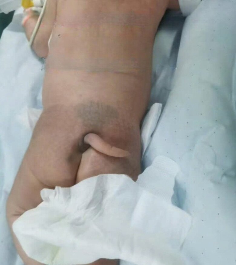 Vợ chồng sản phụ hốt hoảng trước ngoại hình của em bé.