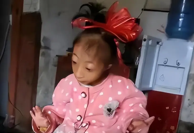 Sinh con gái có gương mặt khác lạ, đoàn xiếc đòi mua với giá 170 triệu, giờ đứa bé lên 14 tuổi đáng yêu và biết đỡ đần mẹ - 6