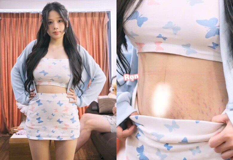 Trước đó, bà xã Trọng Lân từng chia sẻ tình trạng vùng da bụng sau hơn 1 tháng sinh con.