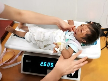 Sinh con gái có gương mặt khác lạ, đoàn xiếc đòi mua với giá 170 triệu, giờ đứa bé lên 14 tuổi đáng yêu và biết đỡ đần mẹ