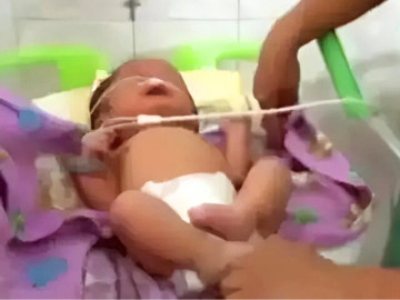 Sinh con ra có ngoại hình khác lạ, ê-kíp y tế bàng hoàng, người mẹ ngã gục ân hận vì một sai lầm trong khi mang bầu