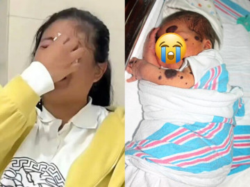 Con mới sinh có ngoại hình khác lạ, người mẹ khóc nghẹn không biết kiếm đâu ra 11 tỷ chữa trị