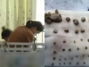 Yêu con - Bé gái 9 tuổi có 56 viên sỏi trong thận, BS chỉ ra nguyên nhân xuất phát từ thói quen sai lầm mà nhiều cha mẹ Việt hay mắc