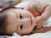 Yêu con - Đứa trẻ sở hữu vết bớt ở 10 vị trí này trên cơ thể báo hiệu số kiếp giàu sang phú quý, tương lai tiền tiêu không hết